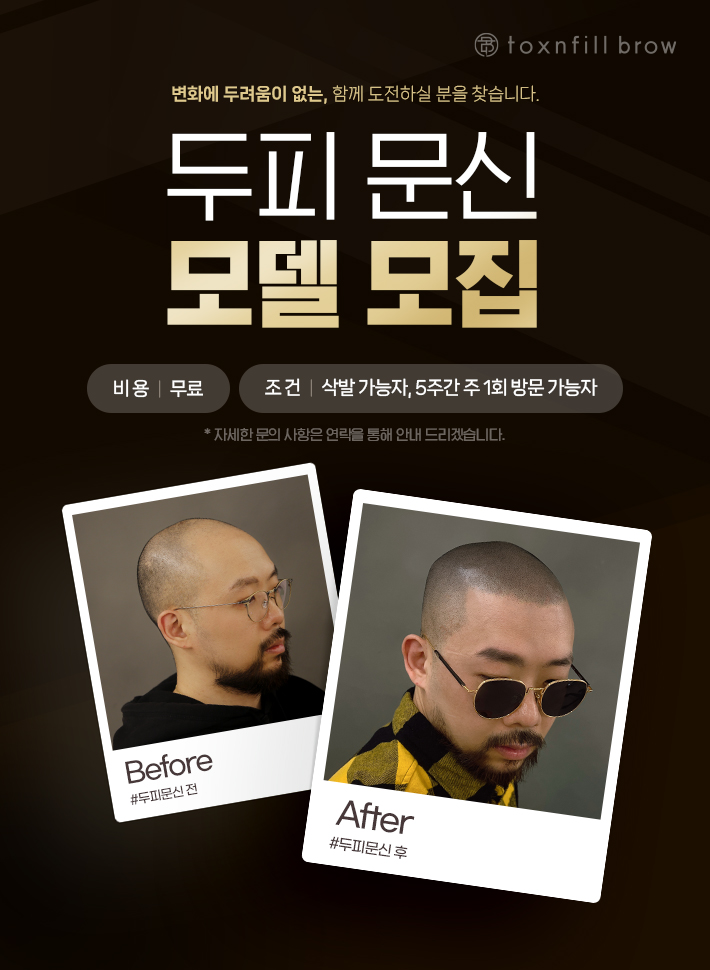 두피 문신 모델 모집